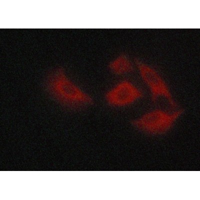 AF5216 staining A549 cells by ICC/IF. Cells were fixed with PFA and permeabilized in 0.1% saponin prior to blocking in 10% serum for 45 minutes at 37C.The primary antibody was diluted 1/400 and incubated with the sample for 1 hour at 37C.