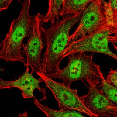 Figure 3: Immunofluorescence analysis of Hela cells using CRAM1 mouse mAb (green). Red: Actin filaments have been labeled with Alexa Fluor-555 phalloidin.