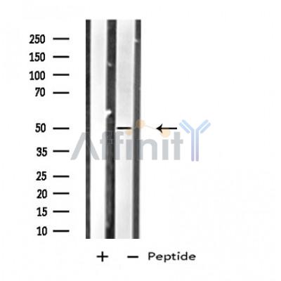Western blot analysis of extracts from HepG2 cells using HTR1B antibody.