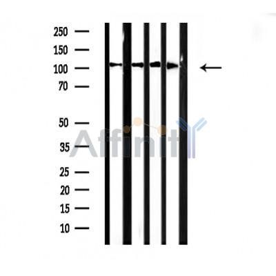 Western blot analysis of Actin alpha-2/3 expression in various lysates