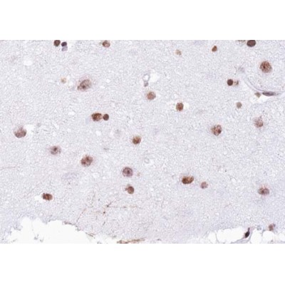 AF1021 at 1/100 staining human Brain tissue sections by IHC-P. The tissue was formaldehyde fixed and a heat mediated antigen retrieval step in citrate buffer was performed.