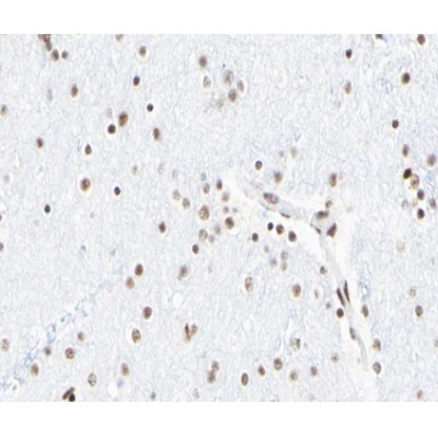 AF1023 at 1/100 staining human Brain tissue sections by IHC-P. The tissue was formaldehyde fixed and a heat mediated antigen retrieval step in citrate buffer was performed.