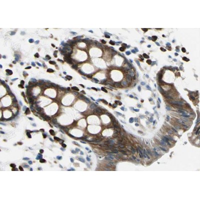 AF0825 at 1/100 staining human Rectum tissue sections by IHC-P. The tissue was formaldehyde fixed and a heat mediated antigen retrieval step in citrate buffer was performed.