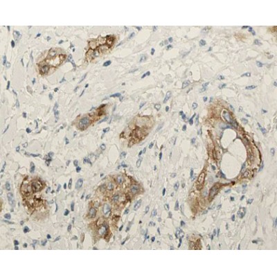 DF6647 at 1/100 staining human lung tissue sections by IHC-P. The tissue was formaldehyde fixed and a heat mediated antigen retrieval step in citrate buffer was performed.