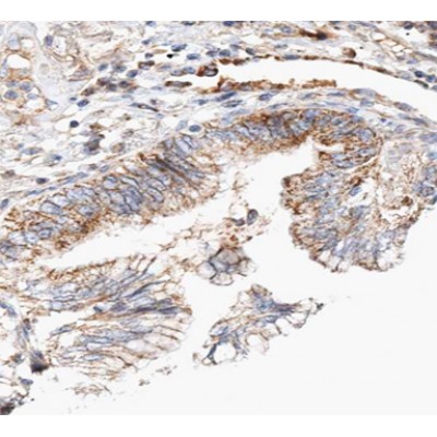 AF0521 at 1/100 staining human lung tissue sections by IHC-P.The tissue was formaldehyde fixed and a heat mediated antigen retrieval step in citrate buffer was performed.The tissue was then blocked and incubated with the antibody for 1.5 hours at 22C.
