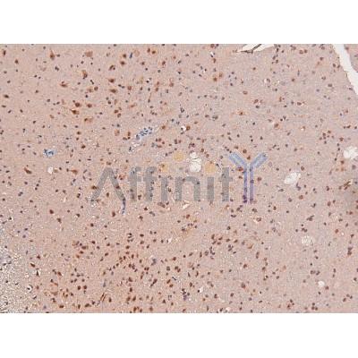 AF8161 at 1/200 staining Mouse brain tissue sections by IHC-P. The tissue was formaldehyde fixed and a heat mediated antigen retrieval step in citrate buffer was performed.