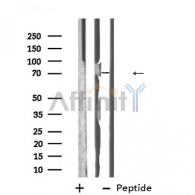 Western blot analysis of ABCG5 using NIH-3T3 whole cell lysates