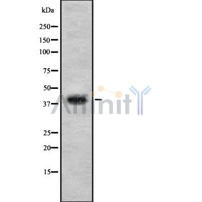 Western blot analysis SP-B using LOVO whole cell lysates