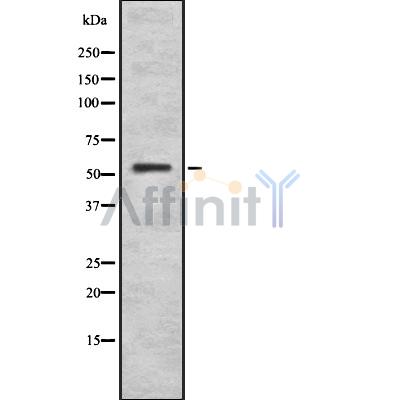 Western blot analysis of ZIC1/2/3/4/5 using HepG2 whole cell lysates