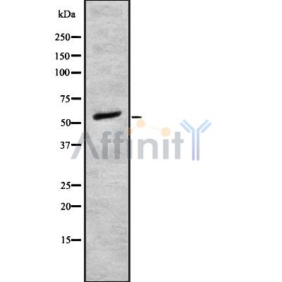 Western blot analysis of Adrenergic Receptor alpha-1B using COS7 whole cell lysates