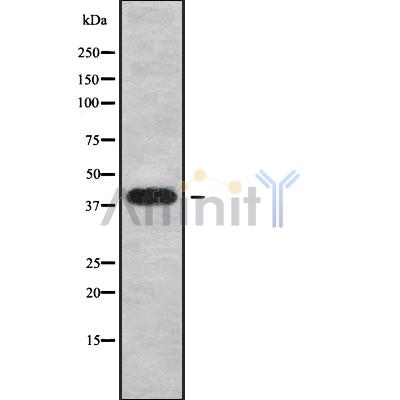 Western blot analysis of XCR1 using COS7 whole cell lysates