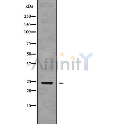 Western blot analysis of ALKBH7 using Jurkat whole cell lysates