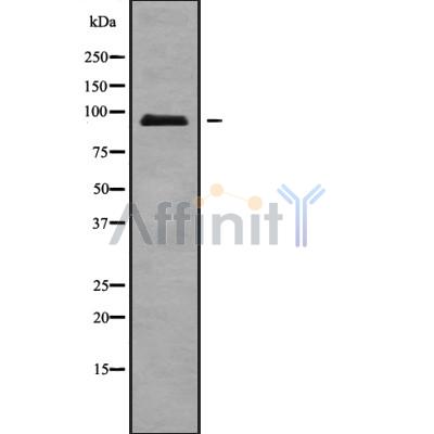 Western blot analysis of ATXN7L1 isoform 2 using COLO205 whole cell lysates