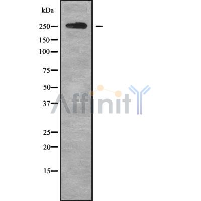 Western blot analysis of ABCA4 using HT29 whole cell lysates