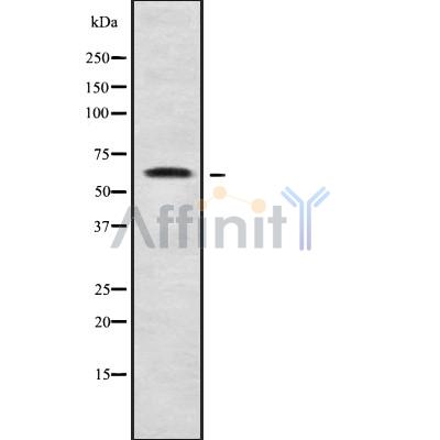 Western blot analysis of ZNF280B using K562 whole cell lysates