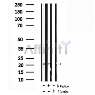Western blot analysis of extracts of Human prostate tissue sample,using phospho-Claudin 7 (Tyr210) antibody.