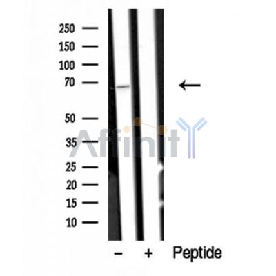 Western blot analysis of A-RAF in lysates of HeLa , using A-RAF Antibody(DF10327).