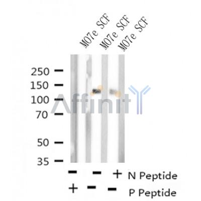 Western blot analysis of Phospho-c-Kit (Tyr723) in lysates of MO7e SCF 50 ng/ml for 2 min , using Phospho-c-Kit (Tyr723) Antibody(AF4401).