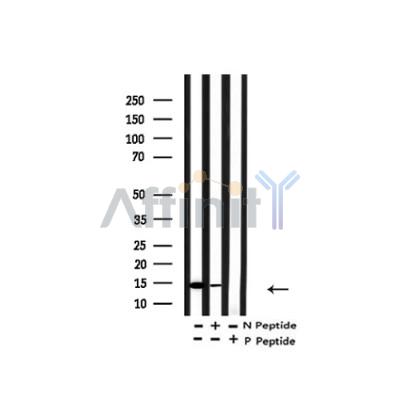 Western blot analysis of Acetyl-H2A.Z ( K4/7/11/13) in lysates of HeLa TSA 1M, 18 hr, using Acetyl-H2A.Z ( K4/7/11/13) Antibody(AF4366).