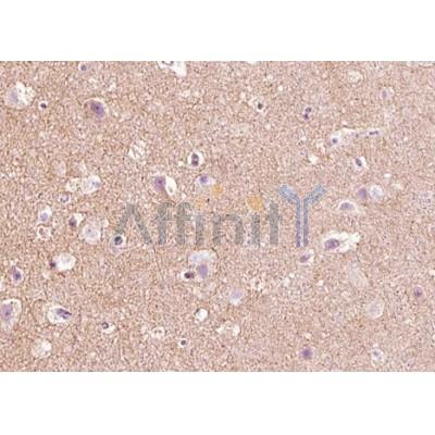 AF5124 at 1/100 staining human brain tissue sections by IHC-P. The tissue was formaldehyde fixed and a heat mediated antigen retrieval step in citrate buffer was performed.