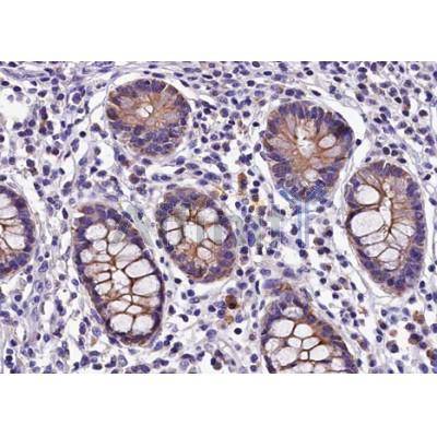 AF5216 at 1/100 staining human colon tissue sections by IHC-P. The tissue was formaldehyde fixed and a heat mediated antigen retrieval step in citrate buffer was performed.