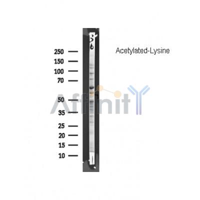 Western blot analysis of Acetylated-Lysine, using Acetyl Lysine antibody.