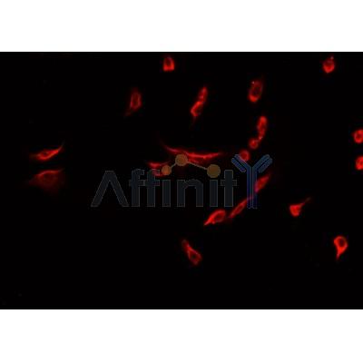 DF7754 staining HepG2? cells by IF/ICC.The sample were fixed with PFA and permeabilized in 0.1% Triton X-100,then blocked in 10% serum for 45 minutes at 25C.The primary antibody was diluted at 1/200 and incubated with the sample for 1 hour at 37C.