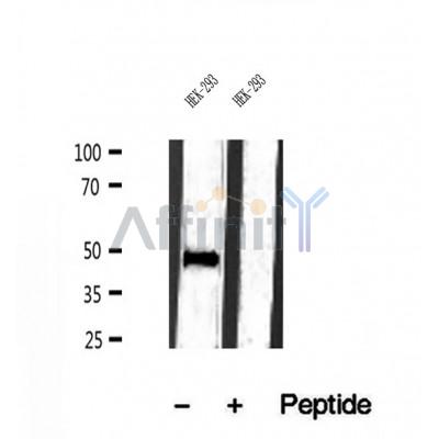 Western blot analysis of extracts of HEK-293 cells, using IFT57 antibody.