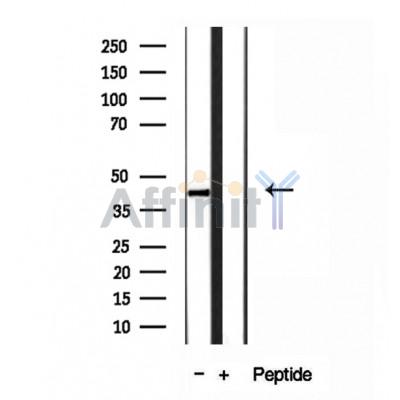 Western blot analysis of extracts of Jurkat cells, using ABHD5 antibody.