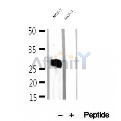 Western blot analysis of extracts of MCF-7 cells, using Mast Cell Chymase antibody.