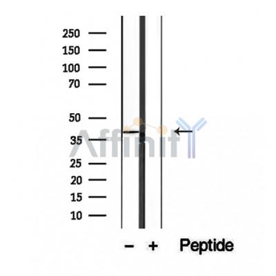 Western blot analysis of extracts of PC-13 cells, using URAT1 antibody.