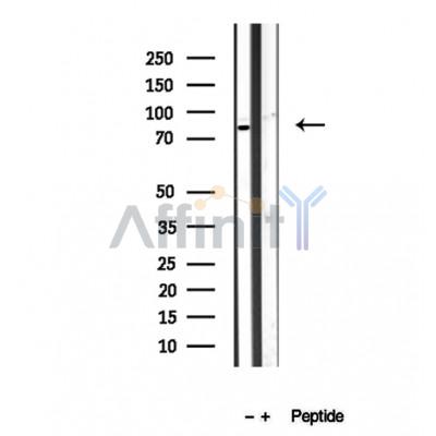 Western blot analysis of extracts of MCF-7 cells, using BBS10 antibody.