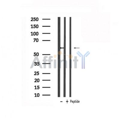 Western blot analysis of extracts from Mouse slpeen, using ANGPT2 Antibody.