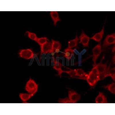 AF8162 staining HepG2 by IF/ICC.The sample were fixed with PFA and permeabilized in 0.1% Triton X-100,then blocked in 10% serum for 45 minutes at 25C.The primary antibody was diluted at 1/200 and incubated with the sample for 1 hour at 37C.