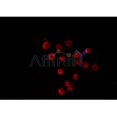 AF0464 staining COS7 by IF/ICC. The sample were fixed with PFA and permeabilized in 0.1% Triton X-100,then blocked in 10% serum for 45 minutes at 25C. The primary antibody was diluted at 1/200 and incubated with the sample for 1 hour at 37C.