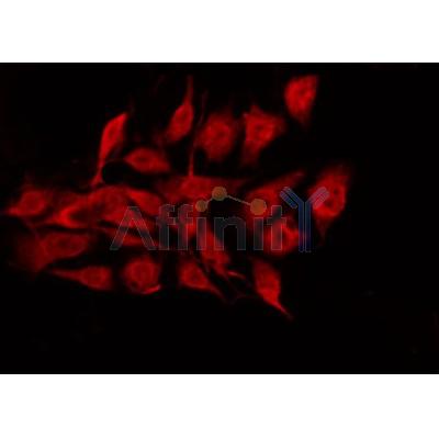 AF3140 staining MCF7 by IF/ICC.The sample were fixed with PFA and permeabilized in 0.1% Triton X-100,then blocked in 10% serum for 45 minutes at 25C.The primary antibody was diluted at 1/200 and incubated with the sample for 1 hour at 37C.