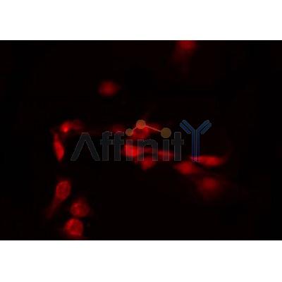 AF9027 staining LOVO by IF/ICC.The sample were fixed with PFA and permeabilized in 0.1% Triton X-100,then blocked in 10% serum for 45 minutes at 25C.The primary antibody was diluted at 1/200 and incubated with the sample for 1 hour at 37C.