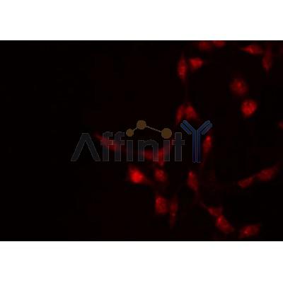 AF3303 staining 293 by IF/ICC.The sample were fixed with PFA and permeabilized in 0.1% Triton X-100,then blocked in 10% serum for 45 minutes at 25C.The primary antibody was diluted at 1/200 and incubated with the sample for 1 hour at 37C.
