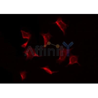 AF6087 staining K562 by IF/ICC.The sample were fixed with PFA and permeabilized in 0.1% Triton X-100,then blocked in 10% serum for 45 minutes at 25C.The primary antibody was diluted at 1/200 and incubated with the sample for 1 hour at 37C.