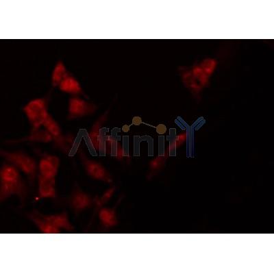 AF3441 staining Hela by IF/ICC.The sample were fixed with PFA and permeabilized in 0.1% Triton X-100,then blocked in 10% serum for 45 minutes at 25C.The primary antibody was diluted at 1/200 and incubated with the sample for 1 hour at 37C.