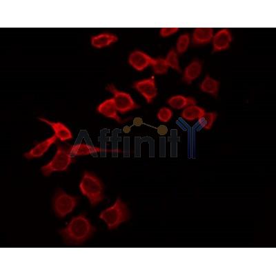AF6152 staining HepG2 by IF/ICC.The sample were fixed with PFA and permeabilized in 0.1% Triton X-100,then blocked in 10% serum for 45 minutes at 25C.The primary antibody was diluted at 1/200 and incubated with the sample for 1 hour at 37C.
