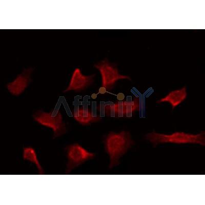AF6357 staining NIH-3T3 by IF/ICC.The sample were fixed with PFA and permeabilized in 0.1% Triton X-100,then blocked in 10% serum for 45 minutes at 25C.The primary antibody was diluted at 1/200 and incubated with the sample for 1 hour at 37C.
