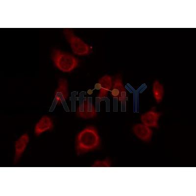 DF4641 staining LOVO by IF/ICC. The primary antibody was diluted at 1/200 and incubated with the sample for 1 hour at 37C.