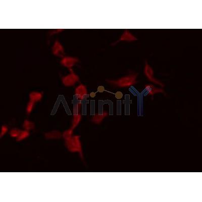 AF5118 staining Hela by IF/ICC.The sample were fixed with PFA and permeabilized in 0.1% Triton X-100,then blocked in 10% serum for 45 minutes at 25C.The primary antibody was diluted at 1/200 and incubated with the sample for 1 hour at 37C.