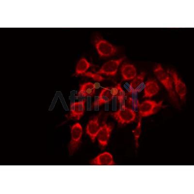 AF5202 staining 293 by IF/ICC.The sample were fixed with PFA and permeabilized in 0.1% Triton X-100,then blocked in 10% serum for 45 minutes at 25C.The primary antibody was diluted at 1/200 and incubated with the sample for 1 hour at 37C.