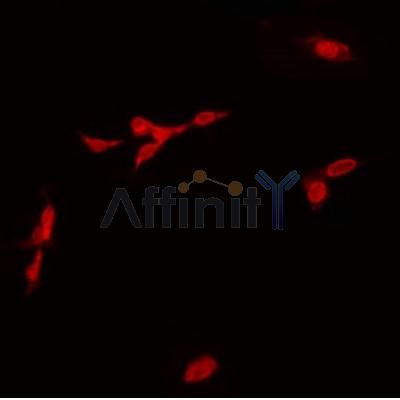AF5217 staining Hela by IF/ICC.The sample were fixed with PFA and permeabilized in 0.1% Triton X-100,then blocked in 10% serum for 45 minutes at 25C.The primary antibody was diluted at 1/200 and incubated with the sample for 1 hour at 37C.