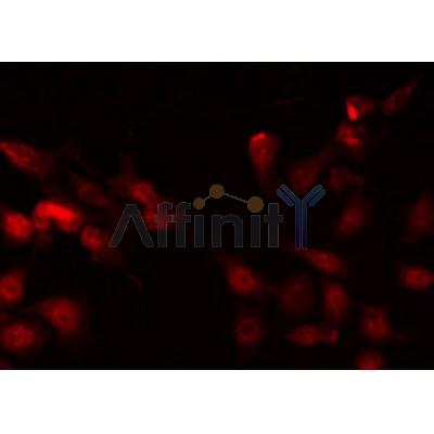 AF5278 staining HepG2 by IF/ICC.The sample were fixed with PFA and permeabilized in 0.1% Triton X-100,then blocked in 10% serum for 45 minutes at 25C.The primary antibody was diluted at 1/200 and incubated with the sample for 1 hour at 37C.