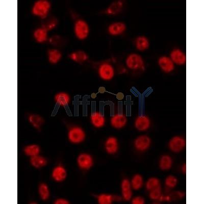 AF0555 staining COLO205 by IF/ICC. The primary antibody was diluted at 1/200 and incubated with the sample for 1 hour at 37C.