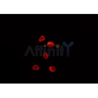 DF2903 staining HepG2 by IF/ICC.The sample were fixed with PFA and permeabilized in 0.1% Triton X-100,then blocked in 10% serum for 45 minutes at 25C.The primary antibody was diluted at 1/200 and incubated with the sample for 1 hour at 37C.