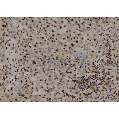DF8768 at 1/100 staining Human liver tissue by IHC-P.The sample was formaldehyde fixed and a heat mediated antigen retrieval step in citrate buffer was performed.The sample was then blocked and incubated with the antibody for 1.5 hours at 22C.